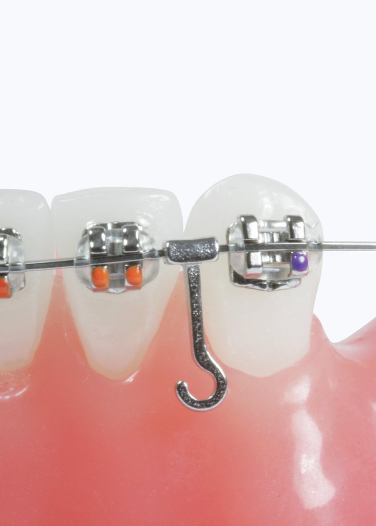 Crimp Arch Hooks Left